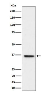 Anti-ULBP1 Rabbit Monoclonal Antibody Boster Bio