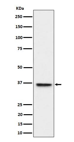 Anti-ULBP1 Rabbit Monoclonal Antibody Boster Bio