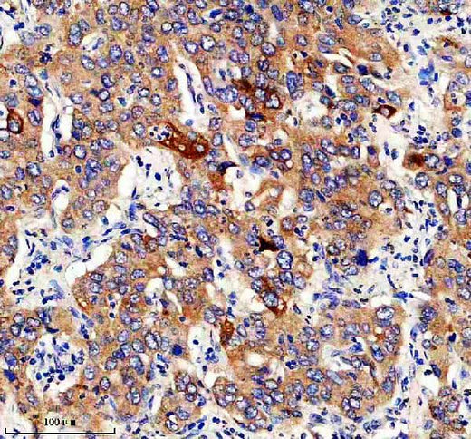 Anti-GFPT1 Rabbit Monoclonal Antibody Boster Bio