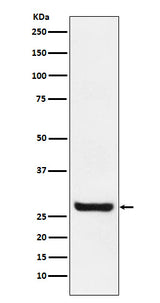 Anti-Sprouty 4 Rabbit Monoclonal Antibody Boster Bio