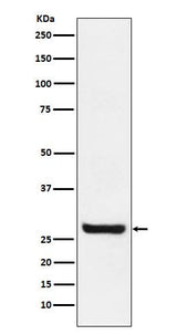Anti-Sprouty 4 Rabbit Monoclonal Antibody Boster Bio
