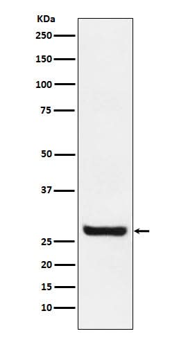 Anti-Sprouty 4 Rabbit Monoclonal Antibody Boster Bio