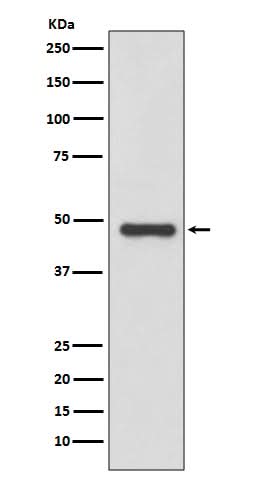 Anti-Urokinase Rabbit Monoclonal Antibody Boster Bio