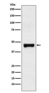 Anti-LRG1 Rabbit Monoclonal Antibody Boster Bio