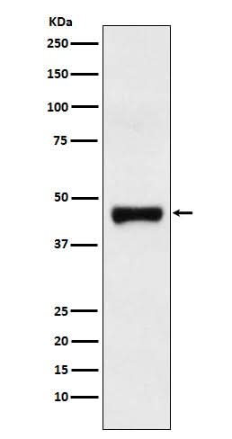 Anti-LRG1 Rabbit Monoclonal Antibody Boster Bio