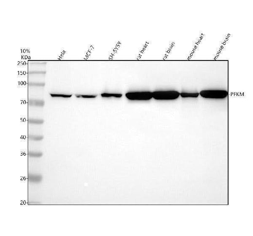 Anti-Fructose 6 Phosphate Kinase Rabbit Monoclonal Antibody Boster Bio