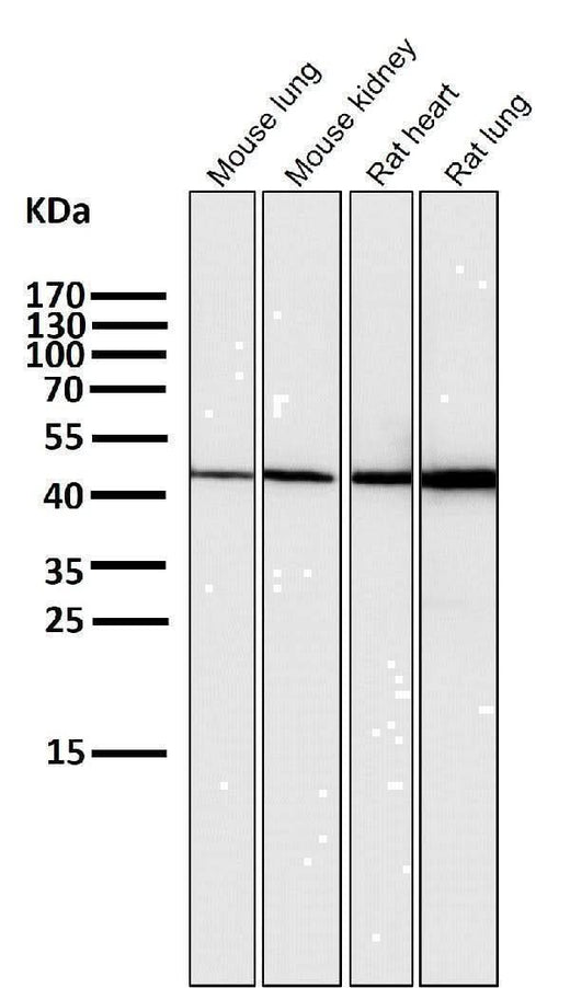 Anti-HMGCS2 Rabbit Monoclonal Antibody Boster Bio