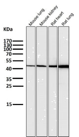 Anti-HMGCS2 Rabbit Monoclonal Antibody Boster Bio