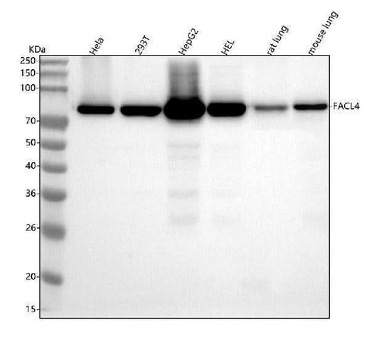 Anti-FACL4 Rabbit Monoclonal Antibody Boster Bio