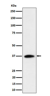Anti-RASSF2 Rabbit Monoclonal Antibody Boster Bio