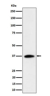 Anti-RASSF2 Rabbit Monoclonal Antibody Boster Bio