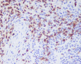 Anti-CD3D Rabbit Monoclonal Antibody Boster Bio
