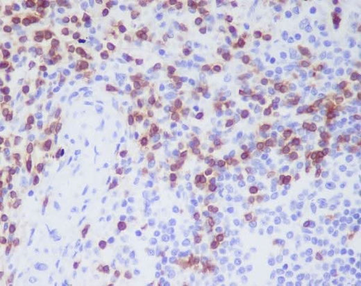 Anti-CD3D Rabbit Monoclonal Antibody Boster Bio