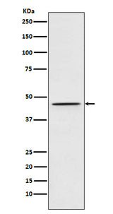 Anti-DEK Rabbit Monoclonal Antibody Boster Bio