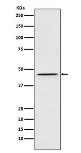 Anti-DEK Rabbit Monoclonal Antibody Boster Bio