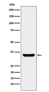 Anti-BOB1 Rabbit Monoclonal Antibody Boster Bio