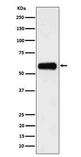 Anti-CD116 Rabbit Monoclonal Antibody Boster Bio