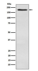 Anti-WSTF Rabbit Monoclonal Antibody Boster Bio