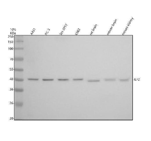 Anti-ILF2 Rabbit Monoclonal Antibody Boster Bio