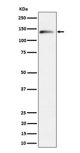Anti-delta 2 Catenin Rabbit Monoclonal Antibody Boster Bio
