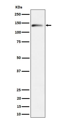 Anti-delta 2 Catenin Rabbit Monoclonal Antibody Boster Bio