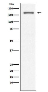 Anti-CD11a ITGAL Rabbit Monoclonal Antibody Boster Bio