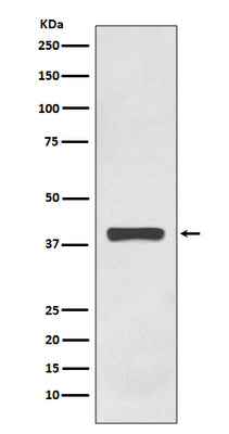 Anti-AMPK gamma 1 Rabbit Monoclonal Antibody Boster Bio