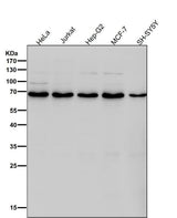 Anti-DLAT Rabbit Monoclonal Antibody Boster Bio