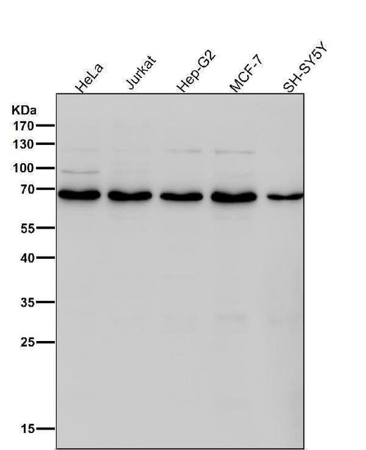 Anti-DLAT Rabbit Monoclonal Antibody Boster Bio