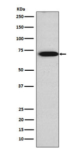 Anti-TRIM29 Rabbit Monoclonal Antibody Boster Bio