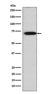 Anti-TRIM29 Rabbit Monoclonal Antibody Boster Bio