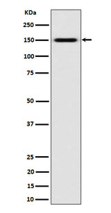 Anti-SLC12A1 / NKCC2 Rabbit Monoclonal Antibody Boster Bio
