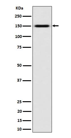 Anti-SLC12A1 / NKCC2 Rabbit Monoclonal Antibody Boster Bio