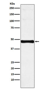 Anti-IRF-9 Rabbit Monoclonal Antibody Boster Bio