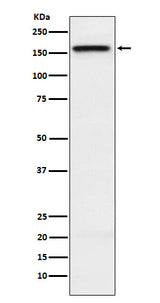 Anti-KIF4A Rabbit Monoclonal Antibody Boster Bio
