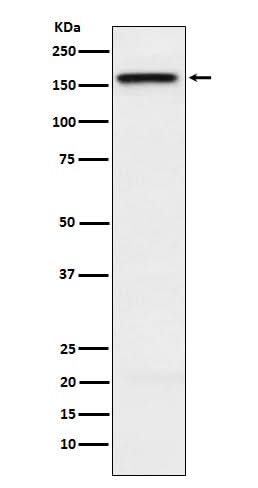 Anti-KIF4A Rabbit Monoclonal Antibody Boster Bio