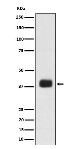 Anti-SR protein repeat Rabbit Monoclonal Antibody Boster Bio