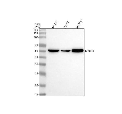 Anti-MMP11 Rabbit Monoclonal Antibody Boster Bio