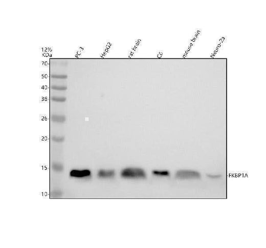 Anti-FKBP12 Rabbit Monoclonal Antibody Boster Bio