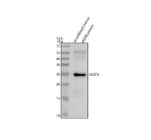 Anti-VEGFB Rabbit Monoclonal Antibody Boster Bio