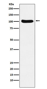 Anti-Exportin2 Rabbit Monoclonal Antibody Boster Bio