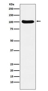 Anti-Exportin2 Rabbit Monoclonal Antibody Boster Bio