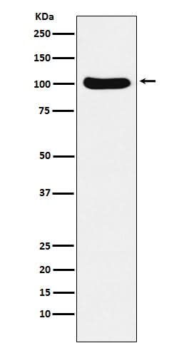 Anti-Exportin2 Rabbit Monoclonal Antibody Boster Bio