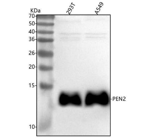 Anti-PEN2 Rabbit Monoclonal Antibody Boster Bio