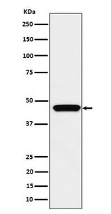 Anti-MK3 Rabbit Monoclonal Antibody Boster Bio
