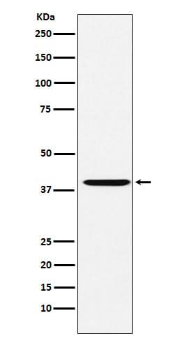 Anti-CAPG Rabbit Monoclonal Antibody Boster Bio