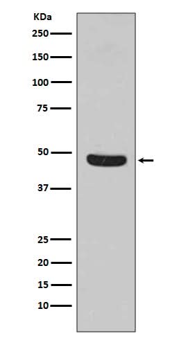 Anti-Flotillin 1 FLOT1 Rabbit Monoclonal Antibody Boster Bio