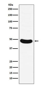 Anti-HB9/HLXB9 Monoclonal Antibody Boster Bio