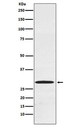 Anti-Cdx1 Rabbit Monoclonal Antibody Boster Bio