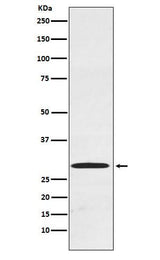 Anti-Cdx1 Rabbit Monoclonal Antibody Boster Bio